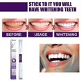 thumbnail image 2 of Bolígrafo Blanqueador de Dientes shaofei Gel para Blanquear Dientes, 2 of 5