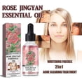 thumbnail image 2 of Rose Essential Oil Lightens Facial Pigmentation, Melanin, Moisturi, 2 of 5