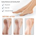 thumbnail image 3 of Foot Scraper Pedicure Foot File, Professional Foot Rasp File Foot Scrubber, Premium Callus Remover for Feet To Remove Dead Skin, Hard Skin, Cracked Heels, Perfect Foot Care Pedicure Tools (2 Pack), 3 of 8