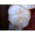 thumbnail image 3 of Intraoral Camera Dental, Works with Eaglesoft, Dexis, Apeteryx, Carestream, Tigerview, 3 of 6