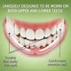thumbnail image 4 of Anti Teeth-Grinding Dental Guard-Ready to use-No Boiling or Molding, Slim, Sleek and Comfortable Works for Upper and Lower Jaw, relieves pain and corr, 4 of 5
