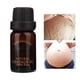 thumbnail image 5 of Estrías Embarazo Cicatriz Reparación Esencial Piel Hidratante Aceite Esencial nutritivo 10g, 5 of 8