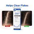 thumbnail image 3 of Quality Choice Therapeutic Shampoo 4.5 oz, Unisex, Soothing Scalp Care 2 Pack, 3 of 5