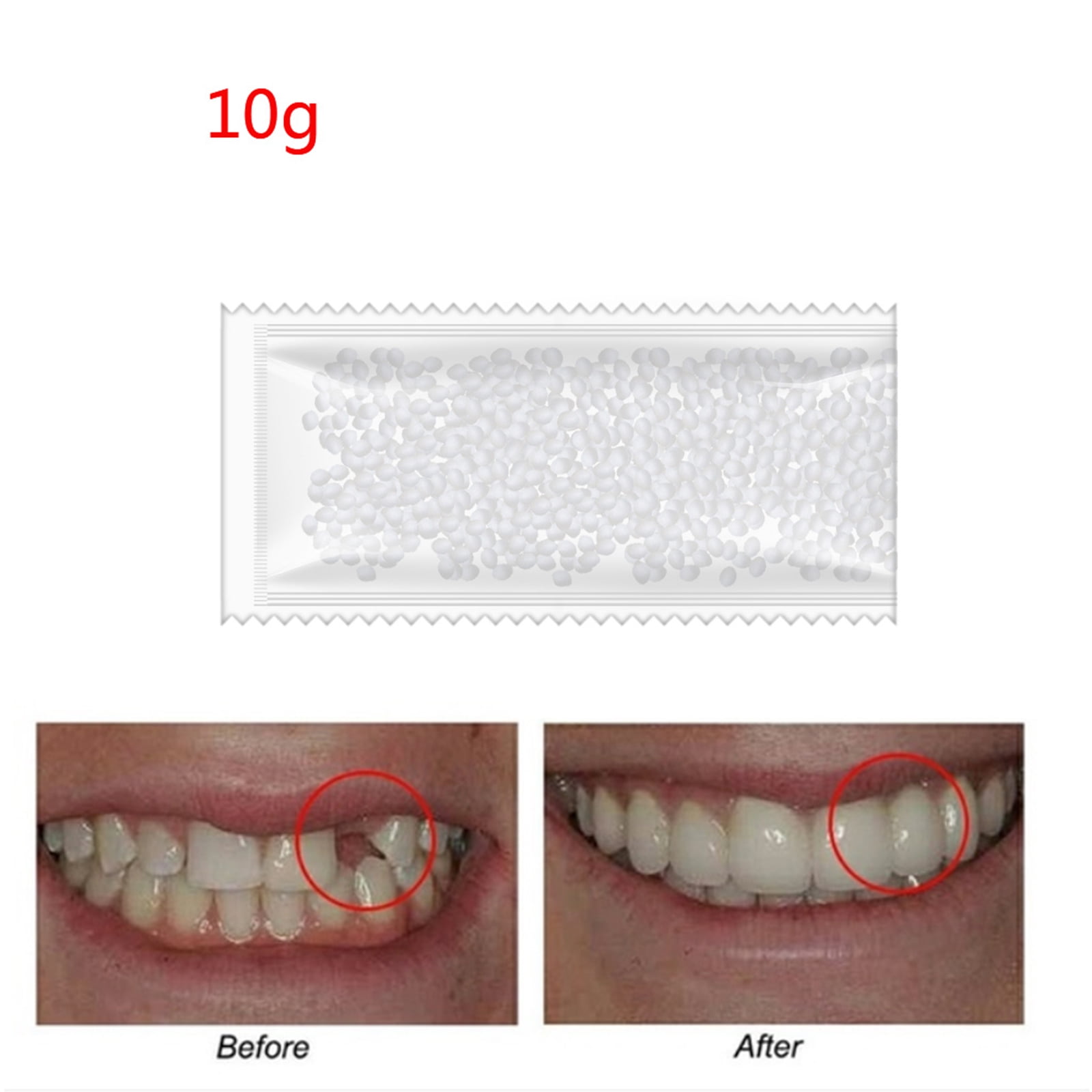 Temporary False Teeth Gaps Repair Kit Vampire Adhesive Denture Solid