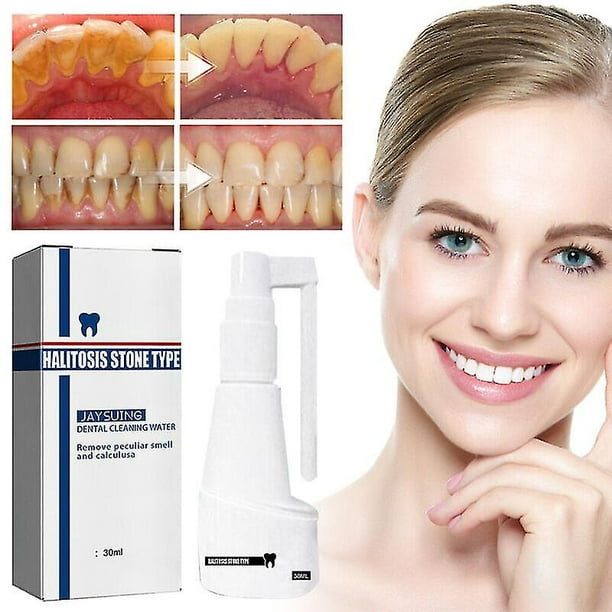 30ml Cálculo que disuelve el aerosol dental Limpiador de dientes bucales Removedor de sarro
