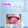 thumbnail image 2 of Plaque disclosing agent, non-tablet plaque disclosing cotton swabs, suitable for children and adults, reveals plaque, helps teach brushing habits, dental care set, 20 per pack, 2 of 5