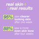 thumbnail image 5 of Liquid Peel Dermalogica Clear Start Breakout Clearing, 30 ml, 5 of 6