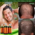 thumbnail image 5 of Botanical Hair Thickening Shampoo with Ginger & Saw Palmetto – Scalp Stimulating Formula for Hair Thinning Prevention, Energizing Scalp Care for Men & Women – 10.2 fl oz, 5 of 10