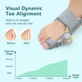 thumbnail image 6 of Bunion Corrector for Left Foot, Big Toe Straightener for Bunion Relief, Adjustable Bunion Splint with Soft Silicone Pad, Bunions Hallux Valgus for All-day Support, Universal Size for Left Feet, 6 of 10