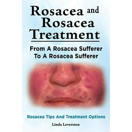 Rosacea and Rosacea Treatment. from a Rosacea Sufferer to a Rosacea Sufferer. Rosacea Tips and Treatment