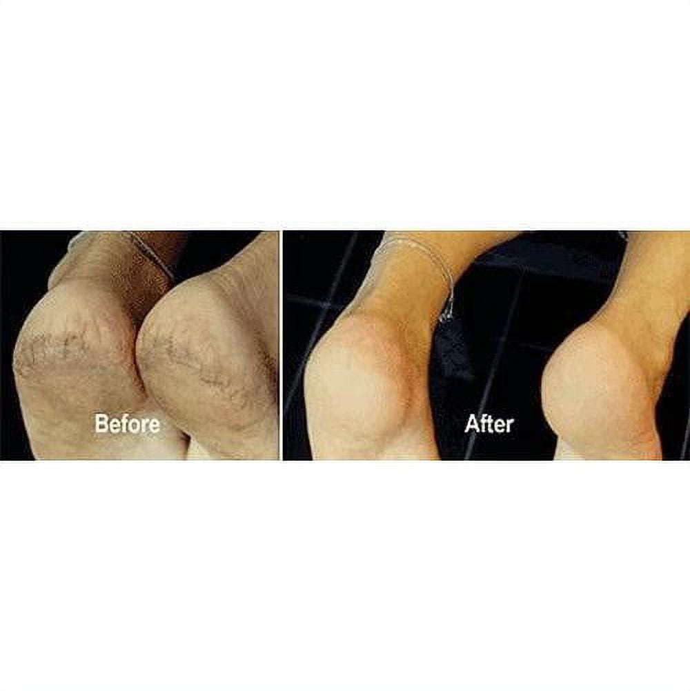 Natural Feet - Foot Callus Eliminator ( gallon ) — Angelina Nail