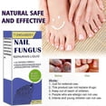 thumbnail image 2 of Powerful Nail Fungus Solution - 30ml Toenail Repair Treatment for Stronger, Healthier Nails, 2 of 5