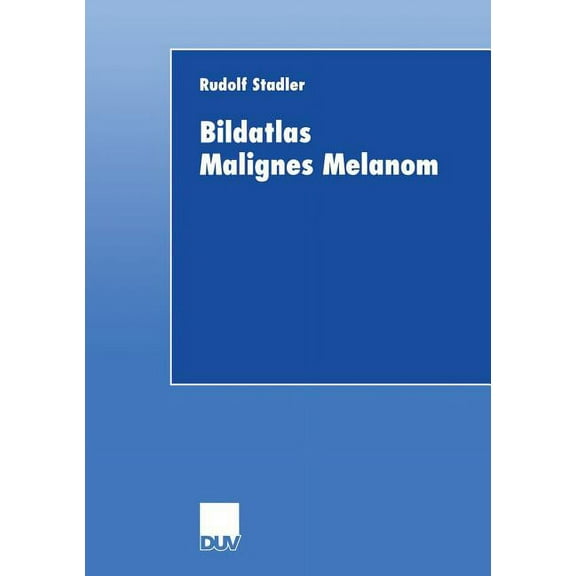 Bildatlas Malignes Melanom, (Paperback)
