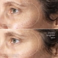 thumbnail image 3 of Serum Medik8 C-Tetra Advanced 30 ml con vitamina C y ácido hialurónico, 3 of 9