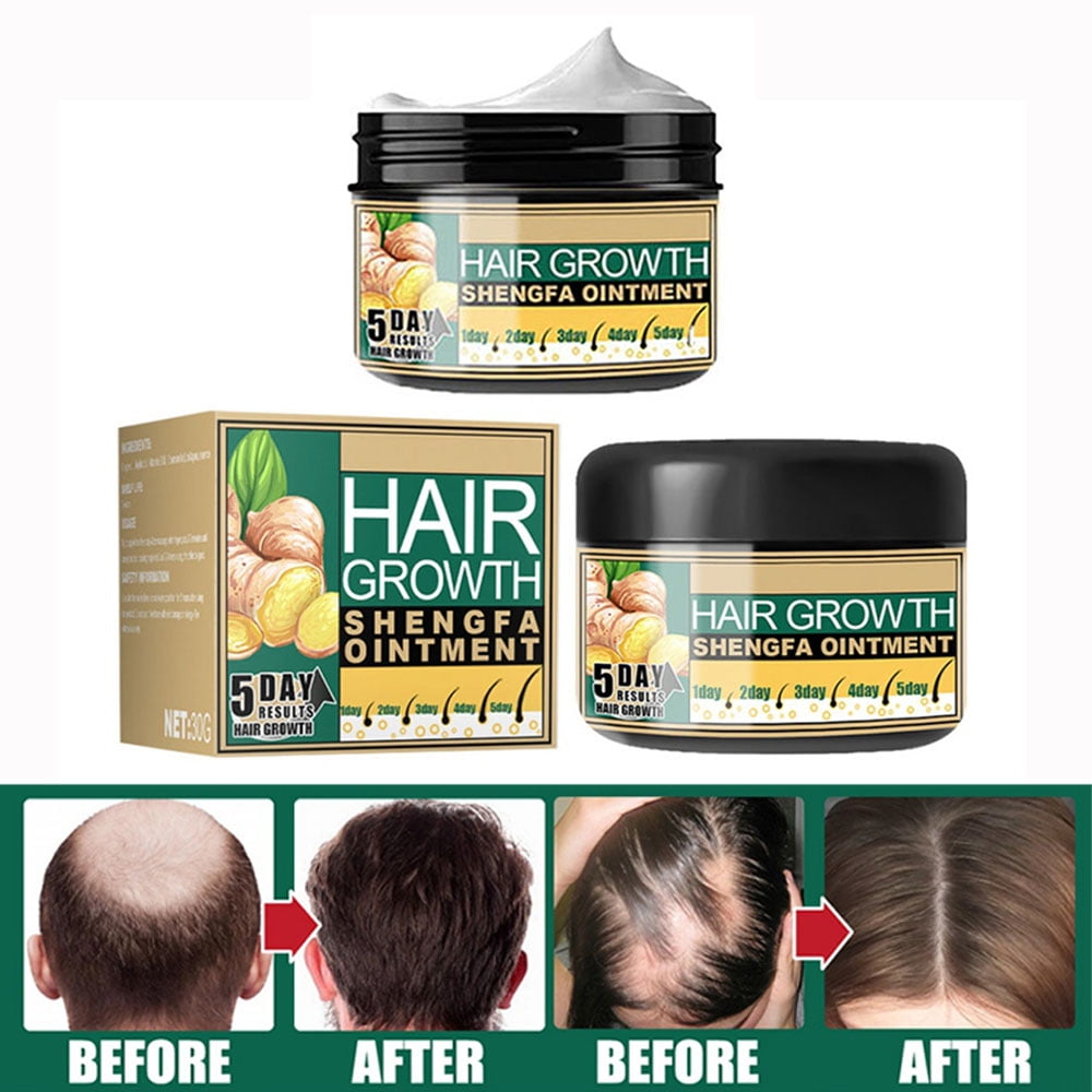 30g Natural Ginger Hair Growth Cream, Massage Hair Follicle Hair Care