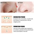 thumbnail image 4 of Blackhead Remover Nose Strips Face Mask, Blackhead Removal Pore Strips, Deep Cleansing Nose Pore Strips For All Skin Types, 4 of 5