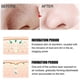 thumbnail image 4 of Blackhead Remover Nose Strips Face Mask, Blackhead Removal Pore Strips, Deep Cleansing Nose Pore Strips For All Skin Types, 4 of 5