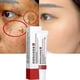 thumbnail image 1 of Crema blanqueadora de pecas para eliminar el melasma, manchas oscuras de pigmento, gel hidratante para el cuidado de la piel Afortunado Sencillez, 1 of 2