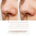 thumbnail image 5 of Unique Bargains 1 Set Facial Pimple Extractor Tool Set Pink, 5 of 7