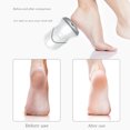thumbnail image 1 of Removedor de callos portátil USB Fiudx pedicura recargable 2 velocidades 3 cabezales de molienda, 1 of 7