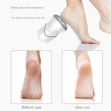 

USB Portable Callus Remover Portable Rechargeable 2-speed Foot Pedicure With Vacuum Adsorption Foot Grinder 3 Grinding Heads