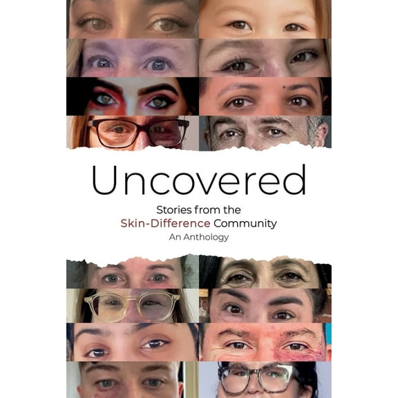 Uncovered: Stories from the Skin-Difference Community, (Paperback)