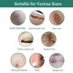 thumbnail image 5 of EELHOE Crema EELHOE de 30ML para cicatrices y manchas, con extractos naturales que suavizan y aclaran la piel de manera efectiva., 5 of 6