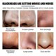 thumbnail image 2 of West & Month Blackhead Stickers 10PCS, 2 of 5