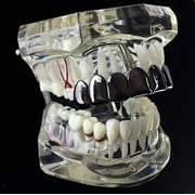 Best Grillz All Black Eight Top Teeth Plain 8 Tooth Hip Hop Blacked Out Mouth Grills
