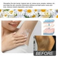& Moisturizing Lotion For Dark Areas Underarms Thighs & Knees Gentle