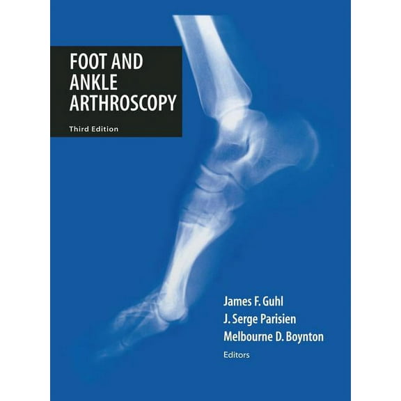 Foot and Ankle Arthroscopy, (Paperback)