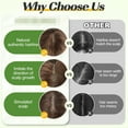 thumbnail image 6 of Hair Toppers for Women, Real Human Hair 130% Density, Hair Loss Cover No Bangs, Hair Extensions for Thinning Hair, Silk Base Three Clips in Topper, Ombre Light Blonde(10inch), 6 of 7