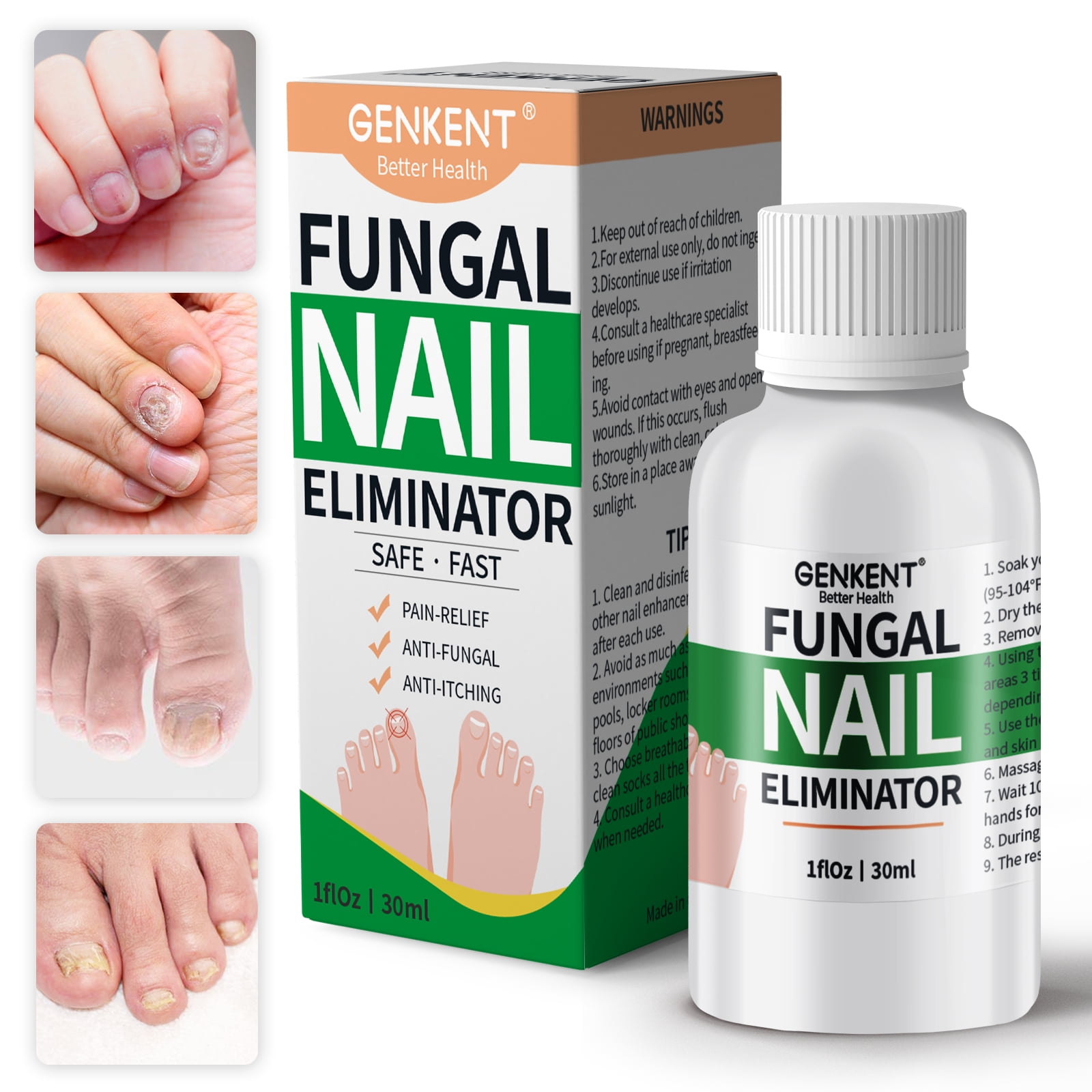 Genkent Fungal Nail Solution, Comprehensive Remedy for Toenail and