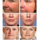 thumbnail image 2 of Suero eliminador instantáneo de arrugas, antienvejecimiento, se desvanece, líneas finas, reafirmante, esencia facial, reparación hidratante, aprieta el cuidado de la piel, 2 of 4