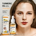 2023 New Turmeric Dark Corrector Serum Oil, Turmeric Face Serum Oil