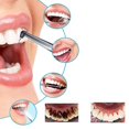 thumbnail image 2 of Plaque Remover For Teeth Cleaning Kit Gum Stimulator Dental Calculus Remover Teeth Cleaning Tool, 2 of 5