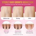 thumbnail image 2 of Shave Oil for Women, Moisturize and Smooth Skin, Prevent Ingrown Hairs & Dryness, Soft Serve After Shave Oil for All Skin Types - 50ML, 2 of 9