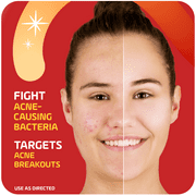 ASEPXIA - Spot Treatment Cream 1 Oz (1 Pack)