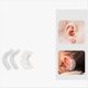 thumbnail image 2 of Corrector de Oreja Protuberante para Bebés, Corrector de Oreja, Corrector de Oreja para Bebés, Corrector de Valgo de Oreja para Bebés A, 2 of 9