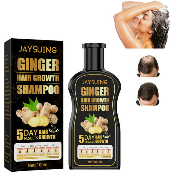 Shampoo Hair Loss And Dandruff