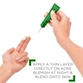thumbnail image 3 of Vichy Laboratoires Normaderm S.O.S Acne Rescue Spot Corrector 0.68oz  New With Box, 3 of 6