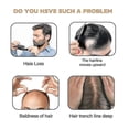 thumbnail image 3 of Hair Boost Shampoo, Moisturizing And Repairing Scalp Strong And Solid Hair, Anti-Hair Loss Hair Conditioner Shampoo, 3 of 5