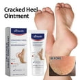 thumbnail image 6 of Herunwer Healthy Foot Cream Moisturizes, Softens and Heals Dry Feet, Cracked Heels and Dry Elbow, 6 of 9