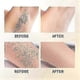 thumbnail image 5 of Smooth Skin Hair Removal Oil with Natural Moisturizers - Cyperus Rotundus Formula for All Skin Types, 5 of 5