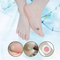 thumbnail image 4 of Corn Removers For Feet Toes,corn Removers With Salicylic Acid, Corn Remover Heel Callus Remover Corn Pads, 4 of 5