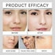 thumbnail image 2 of Whitening and Removing Essence, Anti-Spot Serum, Vitamin C Freckle Solution, Vitamin C Crema 2025, 2 of 4