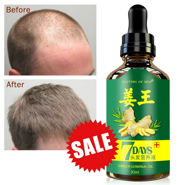 ReGrow 7 Day Ginger Germinal Hair Growth Serum Hairdressing Oil Loss ...
