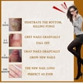 thumbnail image 2 of Esencia para el cuidado de los pies de las uñas Gel para blanquear los pies de las uñas Sywqhk Cuidado Belleza, 2 of 6