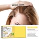 thumbnail image 3 of Champú para el crecimiento del cabello Jaysuing, jabón nutritivo para las raíces del cabello, champú, acondicionador, limpieza del cuero cabelludo, tratamiento anticaspa y esponjoso |, 3 of 5