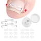 thumbnail image 2 of Kit corrector de uñas encarnadas para uñas curvas, hebilla de armadura de acero inoxidable, herramienta para enderezar uñas encarnadas., 2 of 8